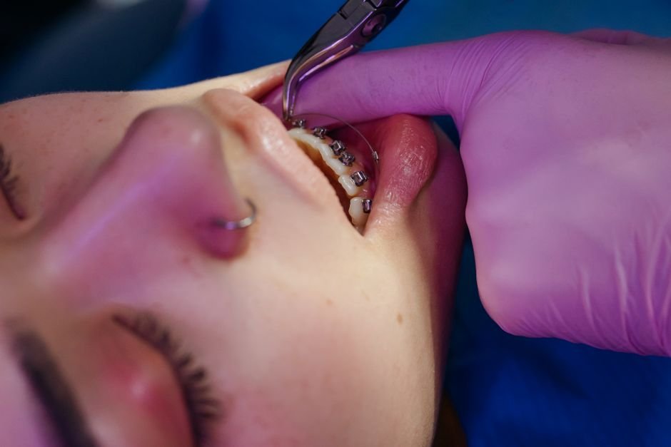 Motricidade orofacial
