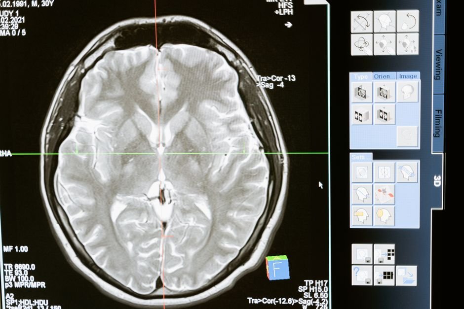 Neuropsicologia